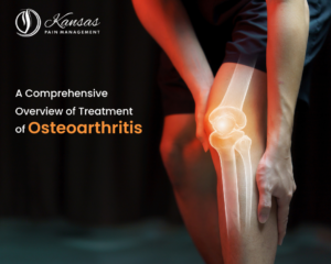 A-Comprehensive-Overview-of-Treatment-of-Osteoarthritis