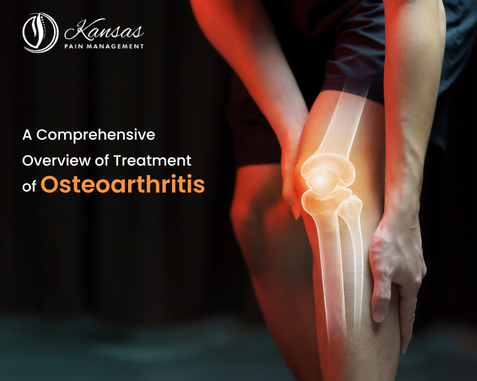 A Comprehensive Overview of Treatment of Osteoarthritis