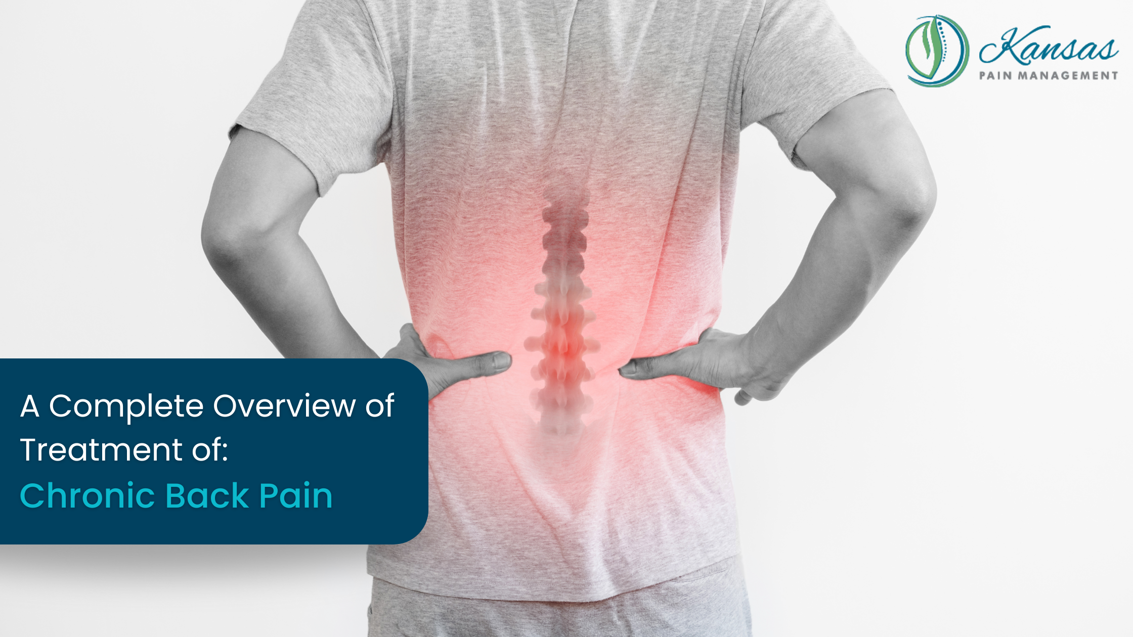 A Complete Overview of Treatment of Chronic Back Pain