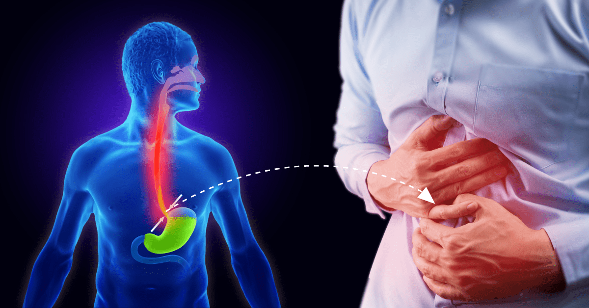 Chronic-AbdominalPain