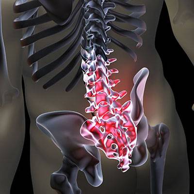 Chronic-Low-Back-Pain