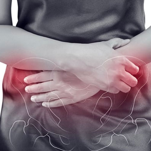 Chronic-Pelvic-Pain