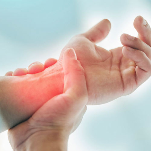 Complex-Regional-Pain-Syndrome