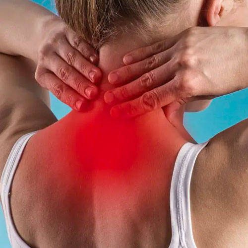 Fibromyalgia