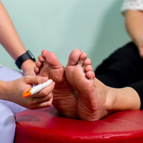 Neuropathy