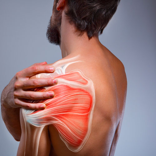 Shoulder-Pain