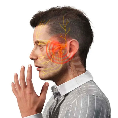 Trigeminal-Neuralgia