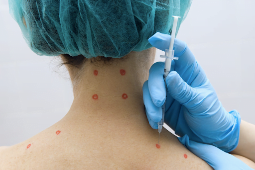 Trigger-Point-Injections0