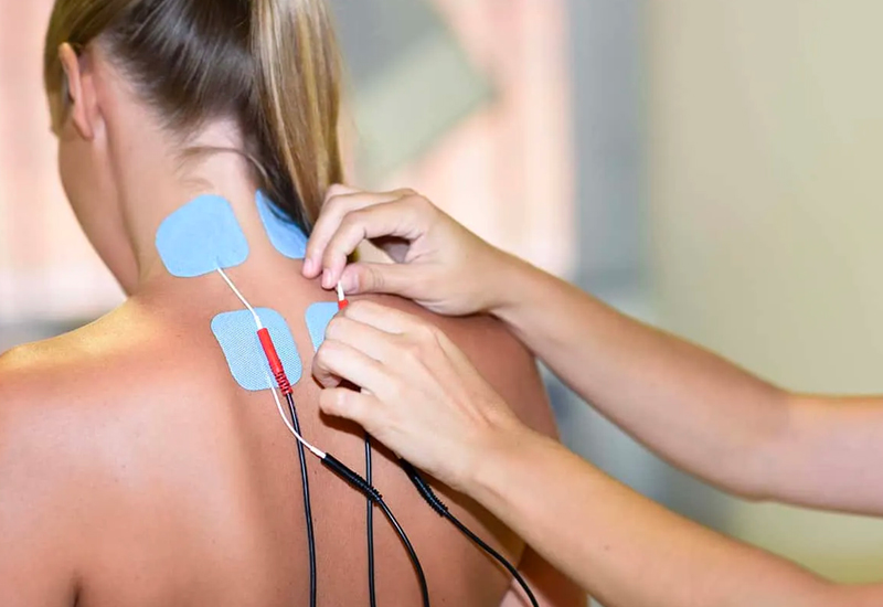 peripheral nerve stimulator