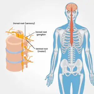 Dorsal-Root-Ganglion-Stimulator-DRG