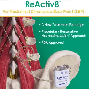 ReActiv8-Procedure