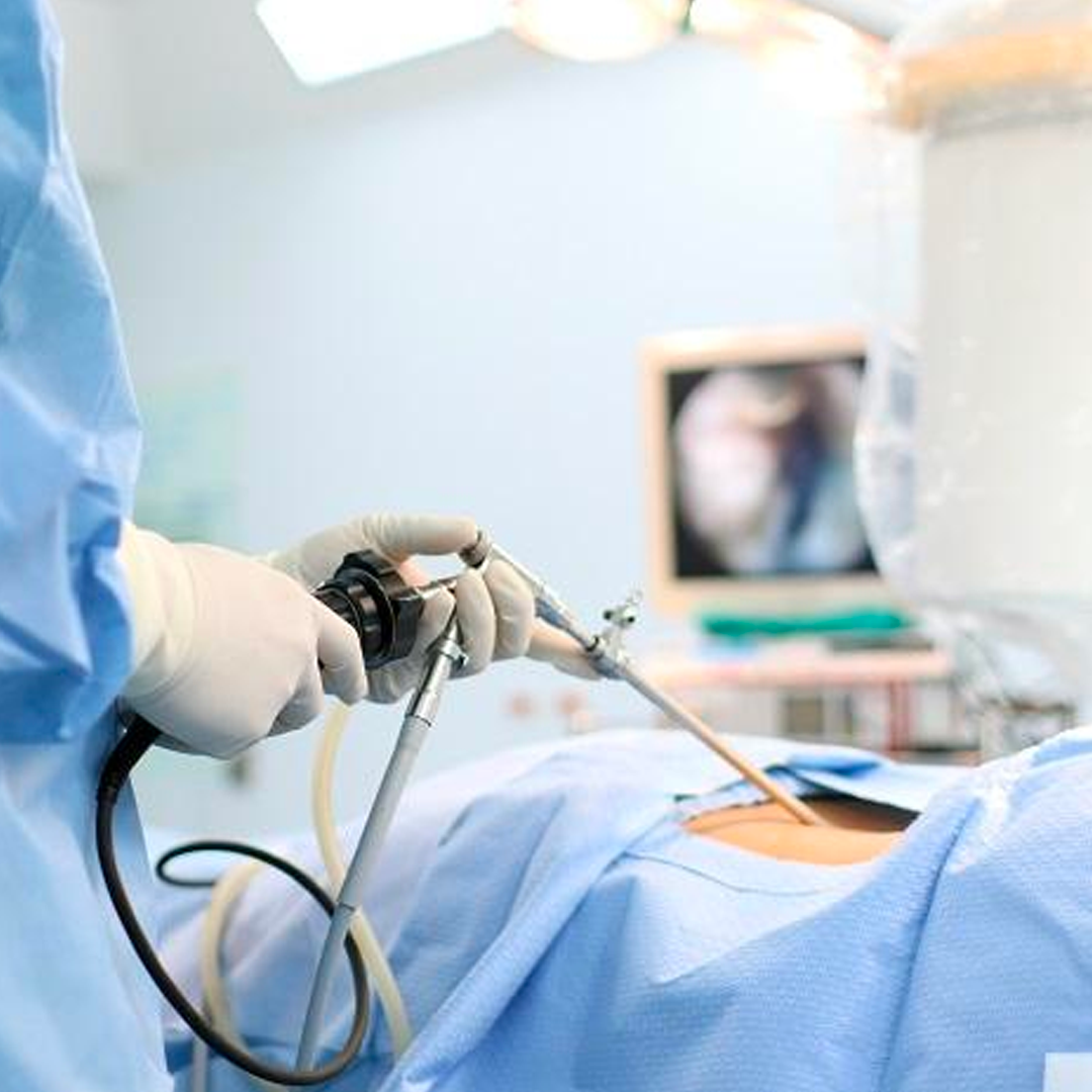 minimal-invasive-surgery