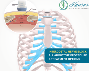 Intercostal Nerve Block Procedure