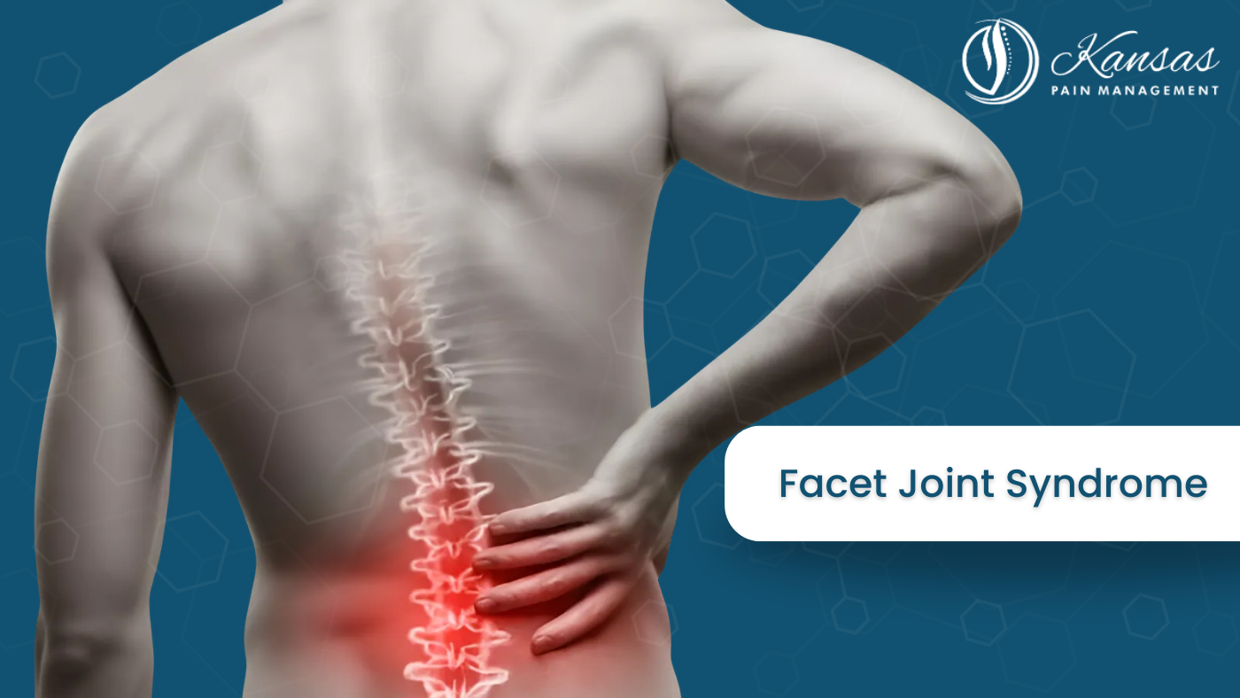 Facet Joint Syndrome