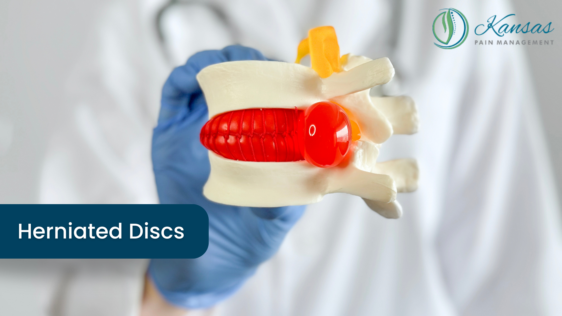 Herniated Discs