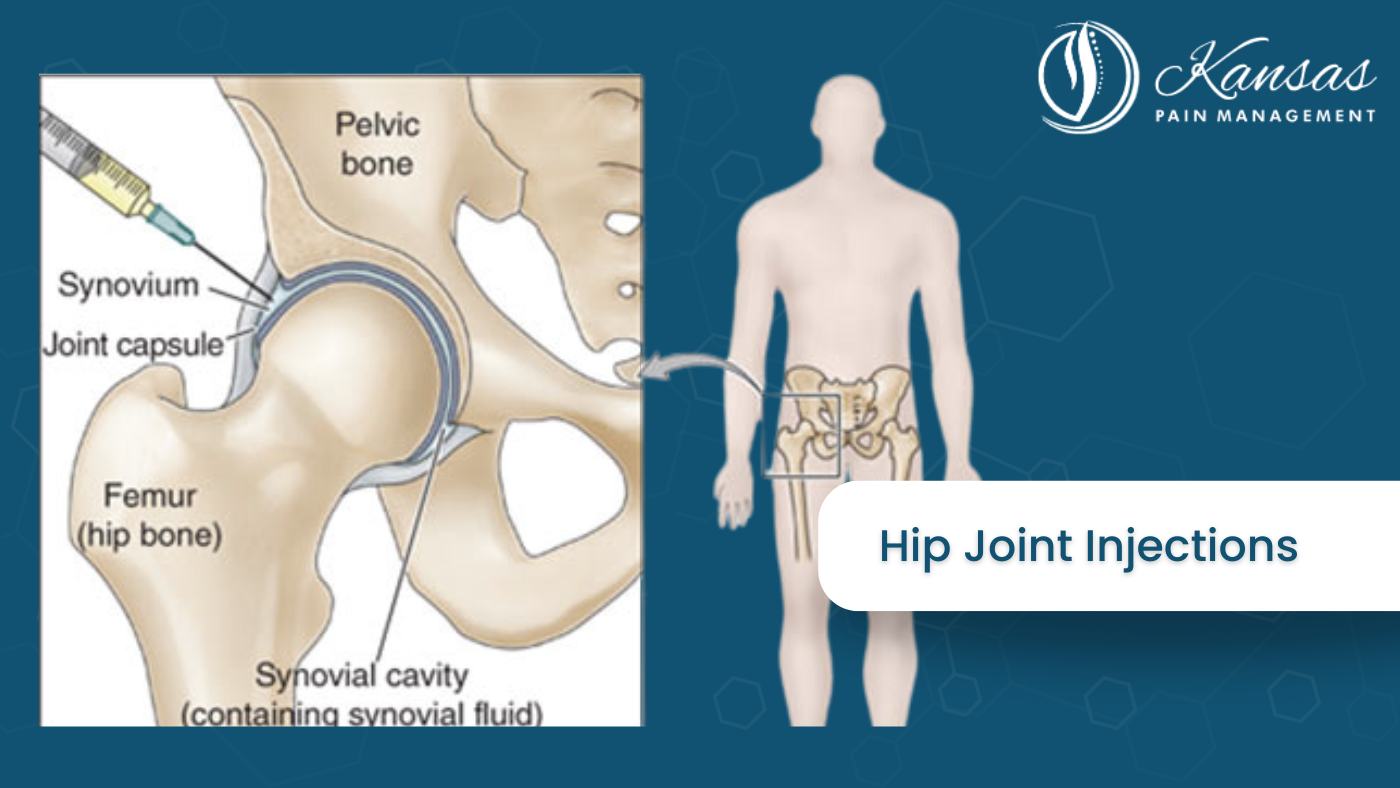 Hip Joint Injections