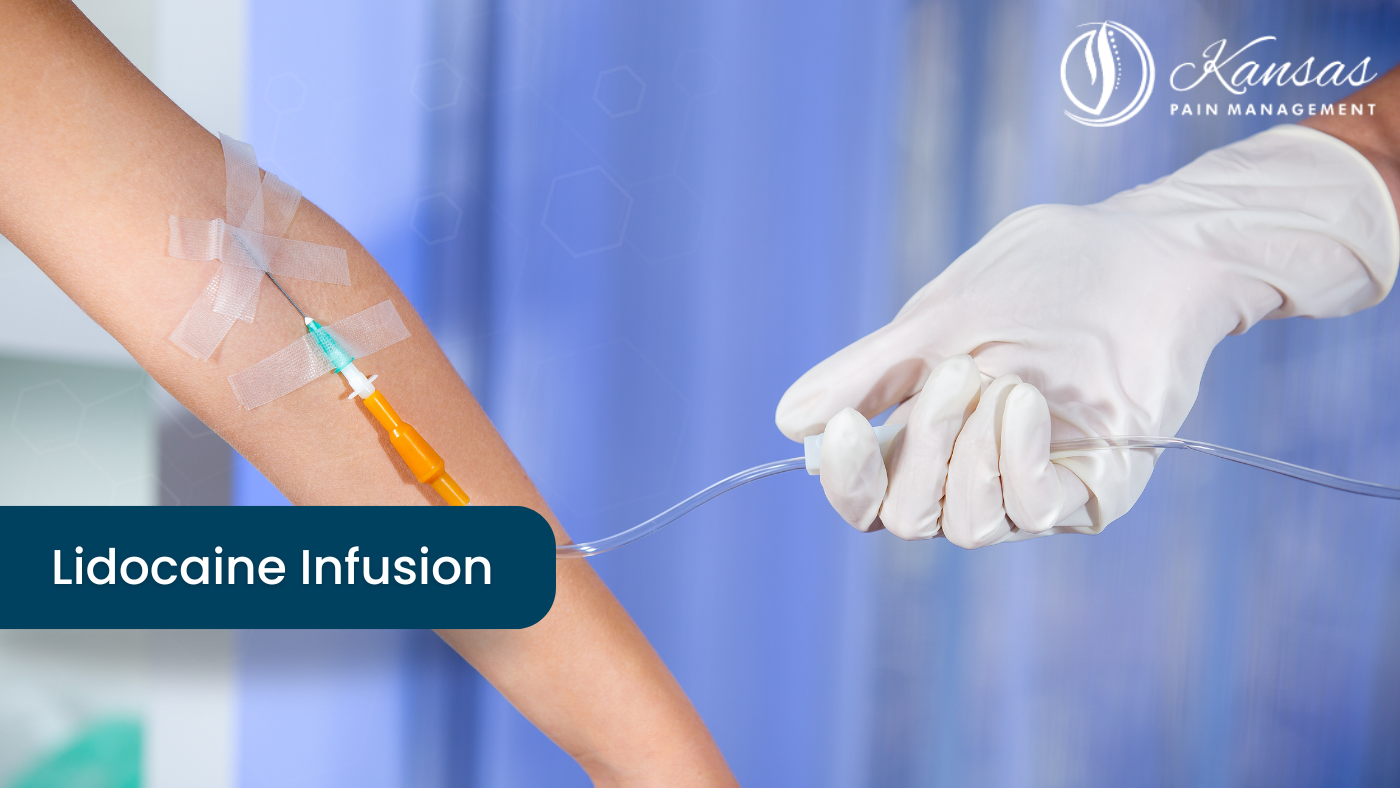 Lidocaine Infusion