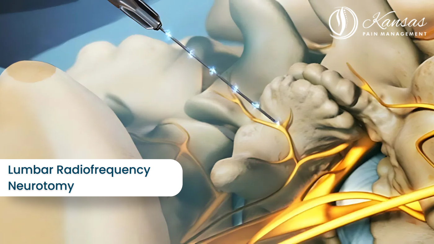 Lumbar Radiofrequency Neurotomy