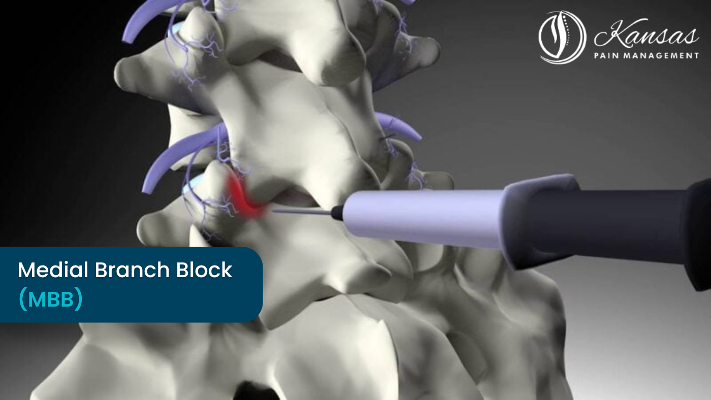 Medial Branch Block