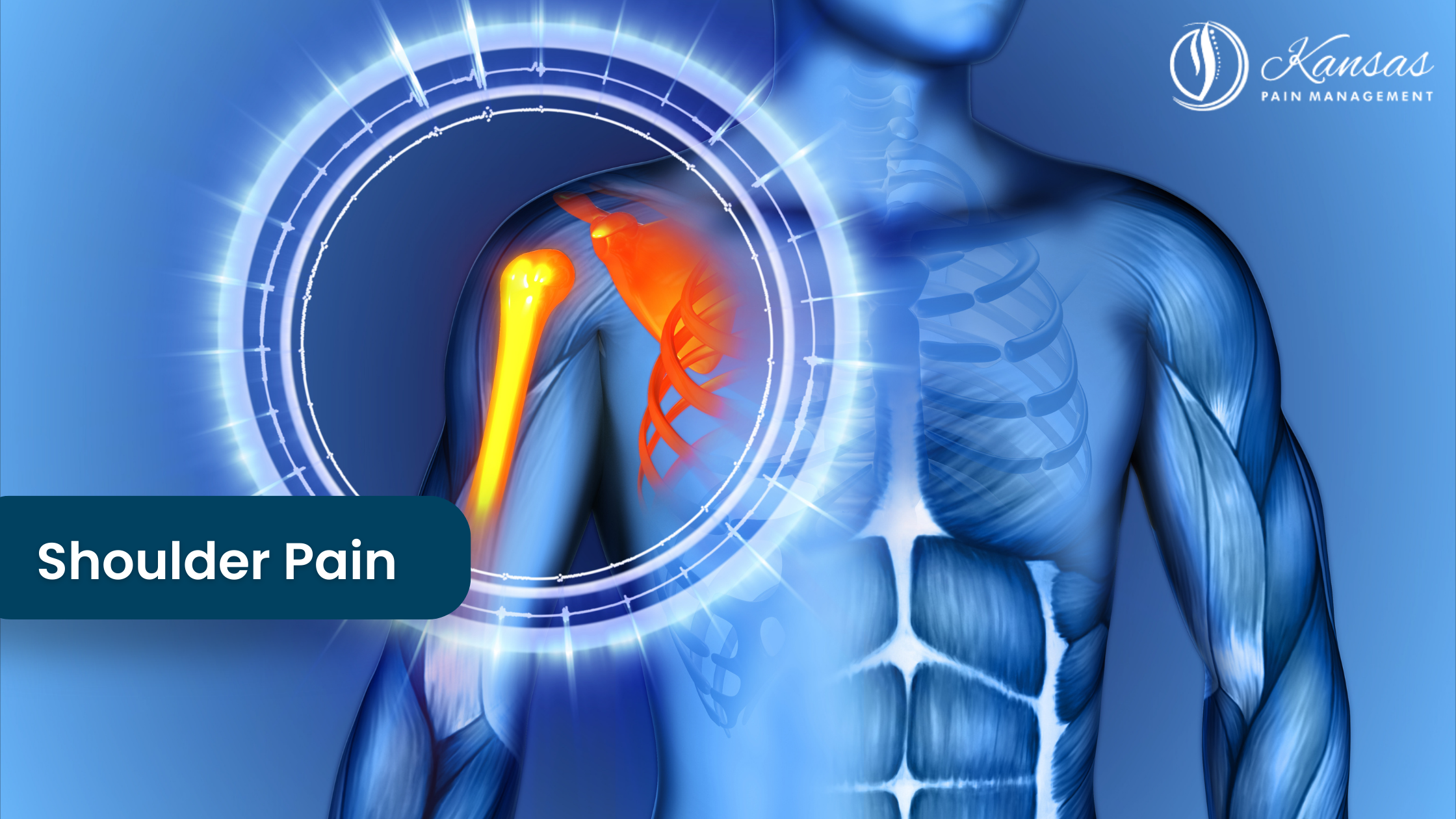 Shoulder Pain