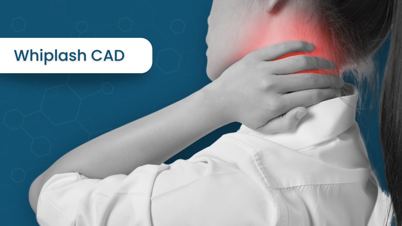 Whiplash CAD