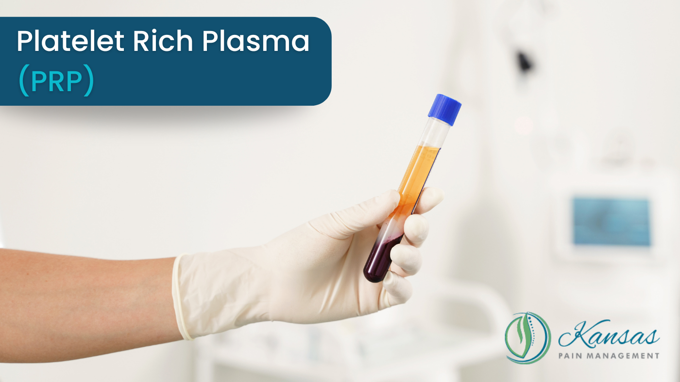 Platelet Rich Plasma